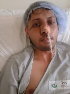 RARE SKULL BASE TUMOUR