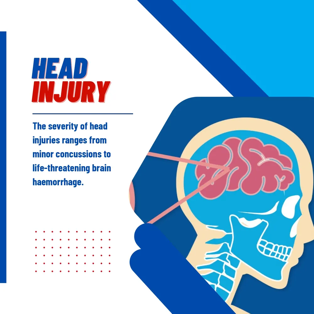 Head Injury