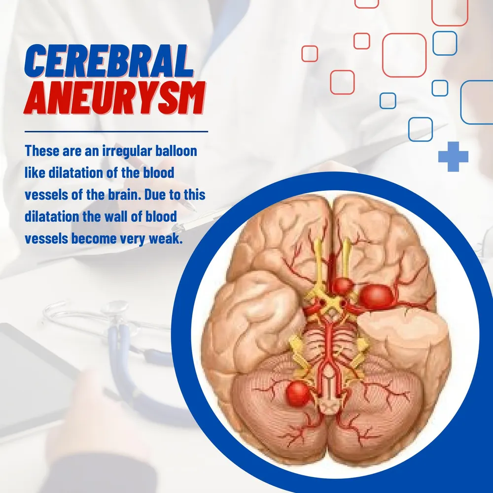 Stroke & Intracranial Bleeding