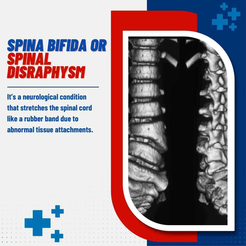 Cervical Spine Surgery